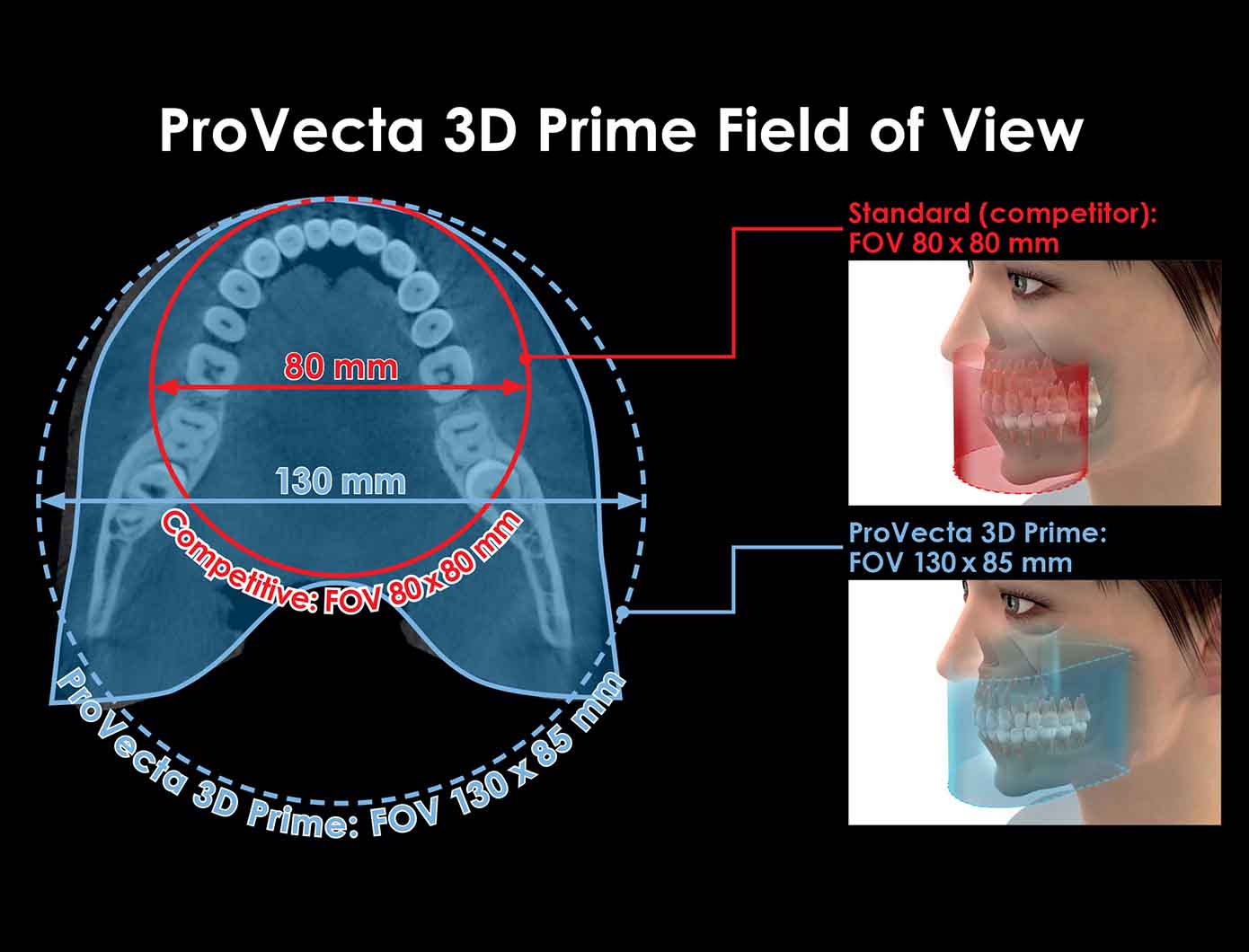 ProVecta 3D Prime - Air Techniques