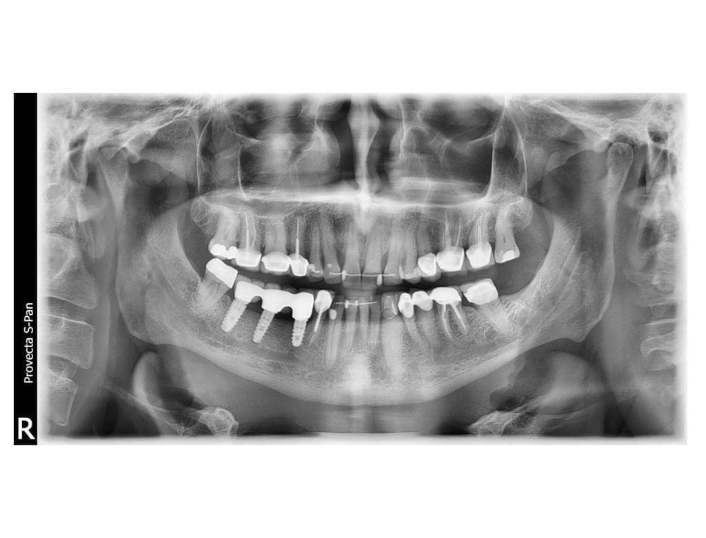 ProVecta SPan Panoramic XRay Air Techniques