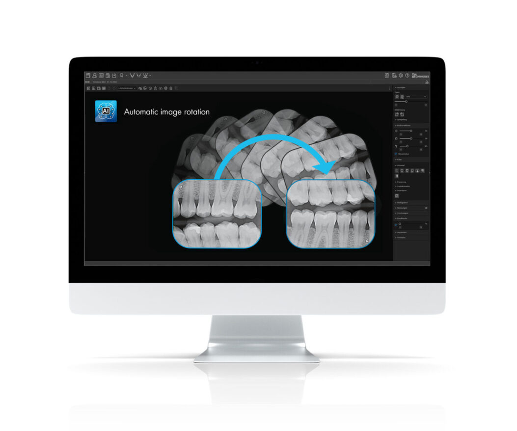 image rotation_visionX image rotation_visionX