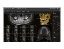 VisionXImplantDriver VisionXImplantDriver