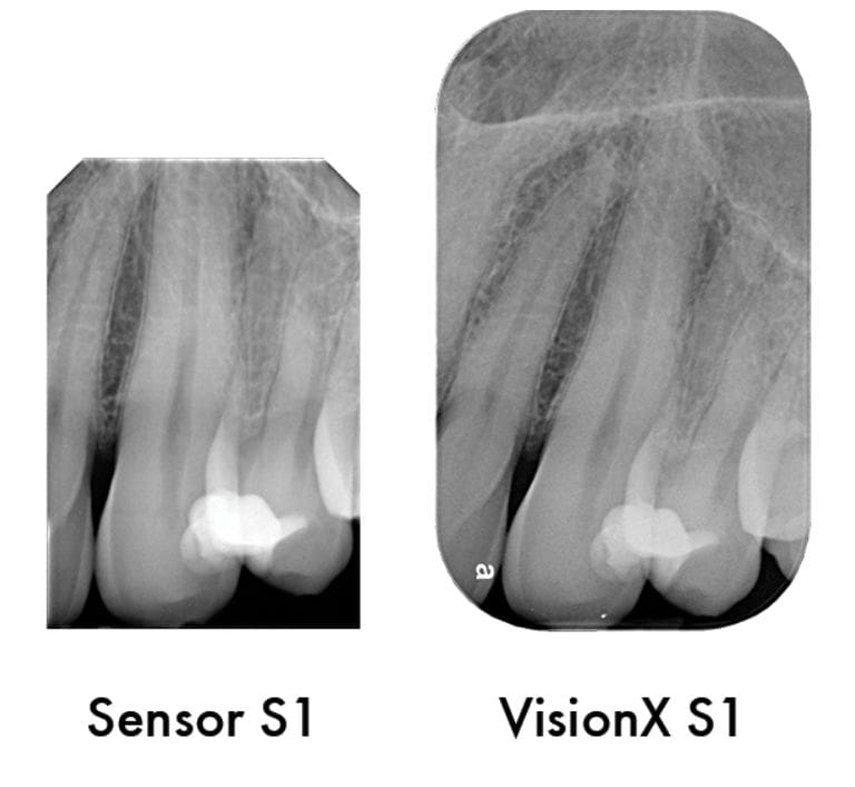 Advantages of ScanX The Right Image The first Time - Air Techniques