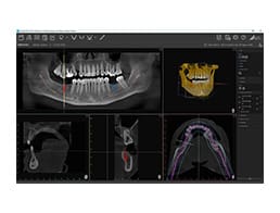 VistaSoft-258x196 VistaSoft-258x196