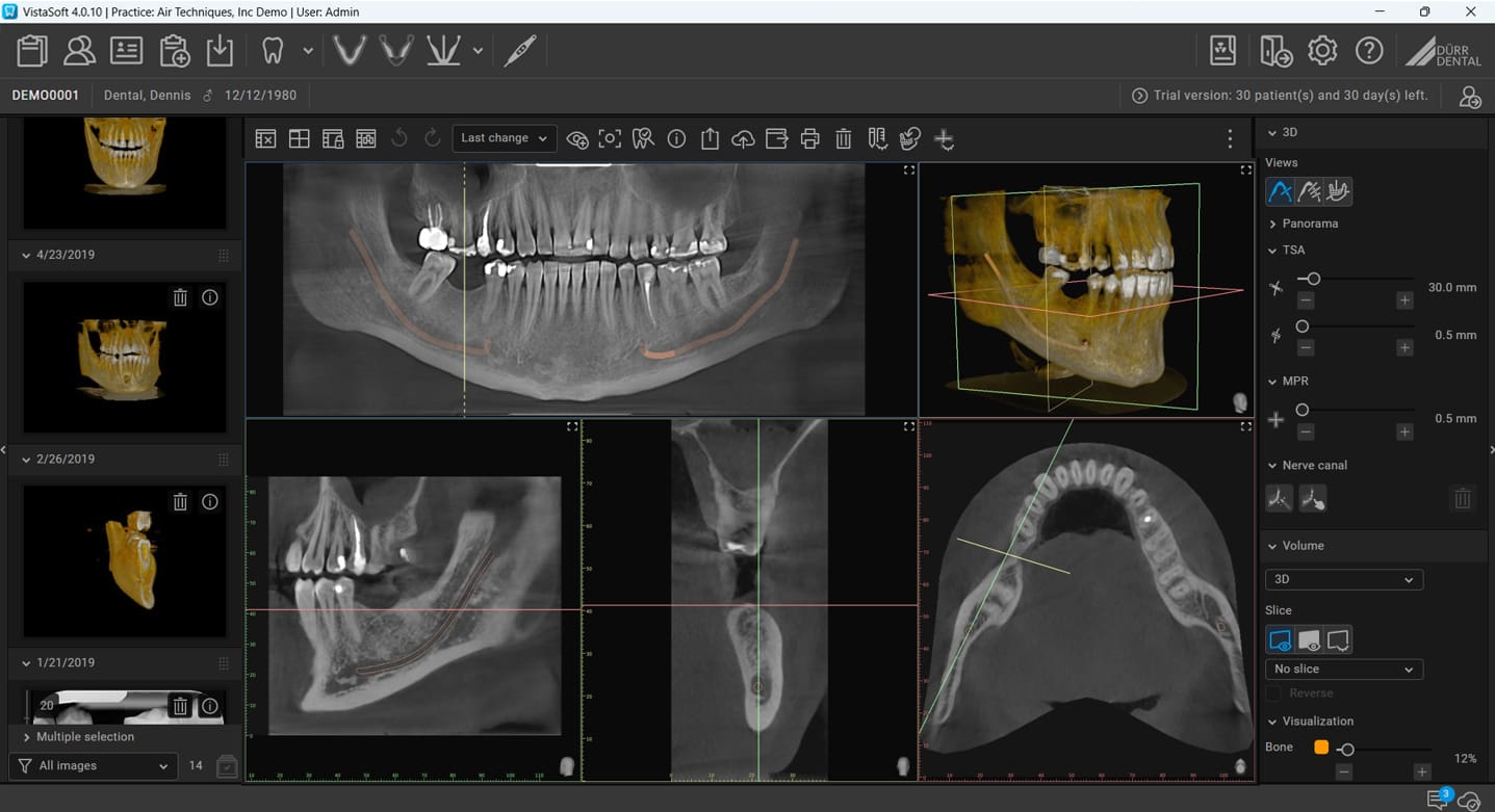 VistaSoftwithoutCBCT